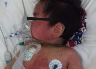 Fallece por negligencia niño con cáncer; ante su gravedad, vergonzosamente fue dado de alta en el CECAN